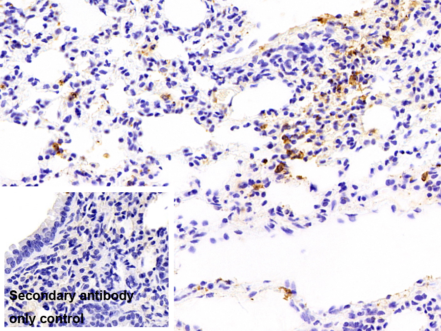 鈣衛(wèi)蛋白(CALPRO)多克隆抗體