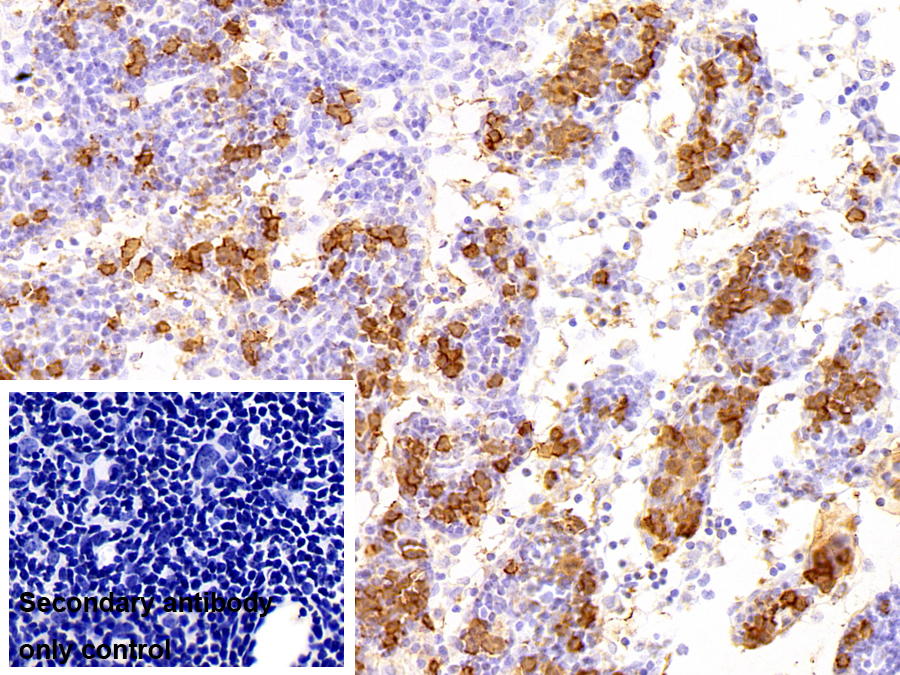 鈣衛(wèi)蛋白(CALPRO)多克隆抗體
