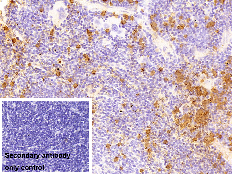 鈣衛(wèi)蛋白(CALPRO)多克隆抗體