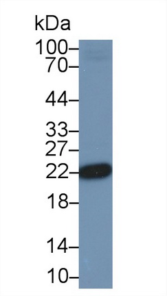 帕金森氏病蛋白7(PARK7)多克隆抗體