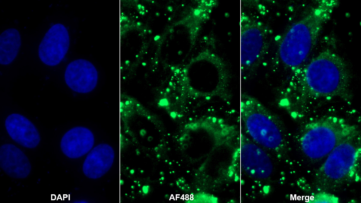 帕金森氏病蛋白7(PARK7)多克隆抗體