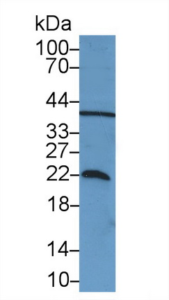 帕金森氏病蛋白7(PARK7)多克隆抗體