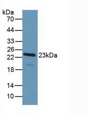 细胞程序性死亡蛋白6(PDCD6)多克隆抗体