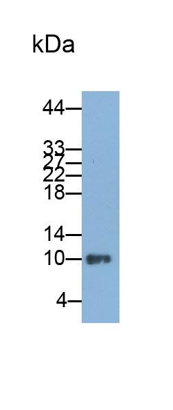 尼曼病蛋白C2(NPC2)多克隆抗体