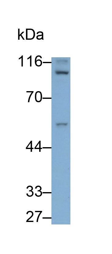 G补缀FHA域血管生成因子1(AGGF1)多克隆抗体