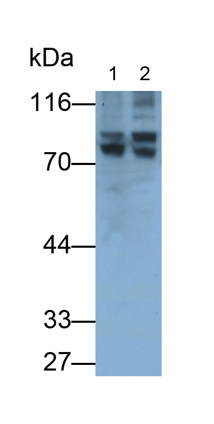 G补缀FHA域血管生成因子1(AGGF1)多克隆抗体