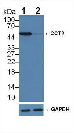 含TCP1伴侣蛋白亚基2(CCT2)多克隆抗体