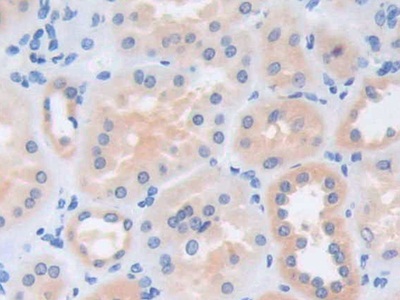 猫眼综合征染色体区候选基因1(CECR1)多克隆抗体