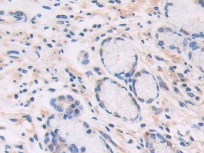 猫眼综合征染色体区候选基因1(CECR1)多克隆抗体