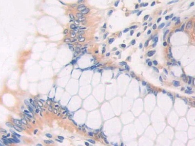 猫眼综合征染色体区候选基因1(CECR1)多克隆抗体