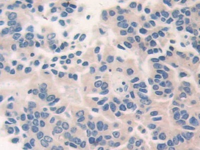 猫眼综合征染色体区候选基因1(CECR1)多克隆抗体