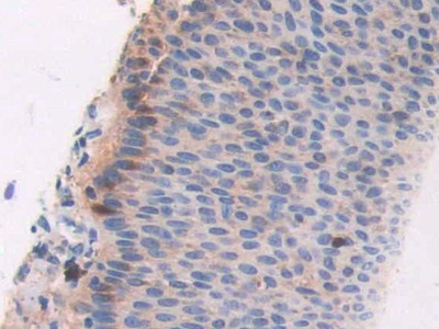 猫眼综合征染色体区候选基因1(CECR1)多克隆抗体