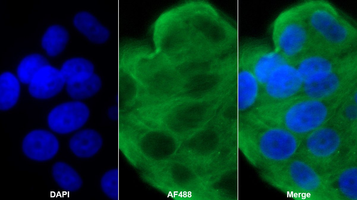 卵巢腫瘤蛋白1(OTUB1)多克隆抗體