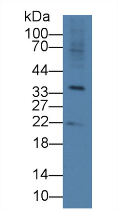 R-脊椎蛋白3(RSPO3)多克隆抗體