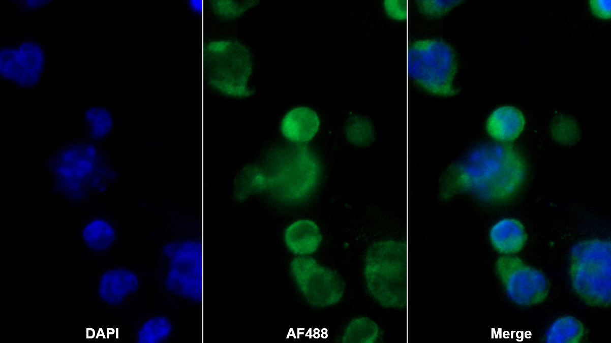 RAS癌基因家族成员RAB37(RAB37)多克隆抗体