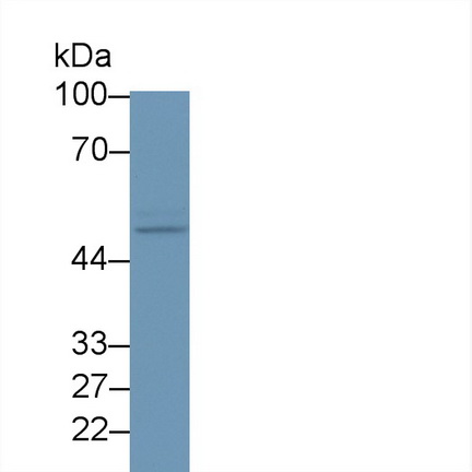 彩斑4-20同源物1抑制因子2(SUV420H2)多克隆抗體