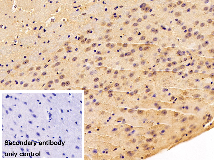 含BRCA1/BRCA2復(fù)合體3亞基(BRCC3)多克隆抗體