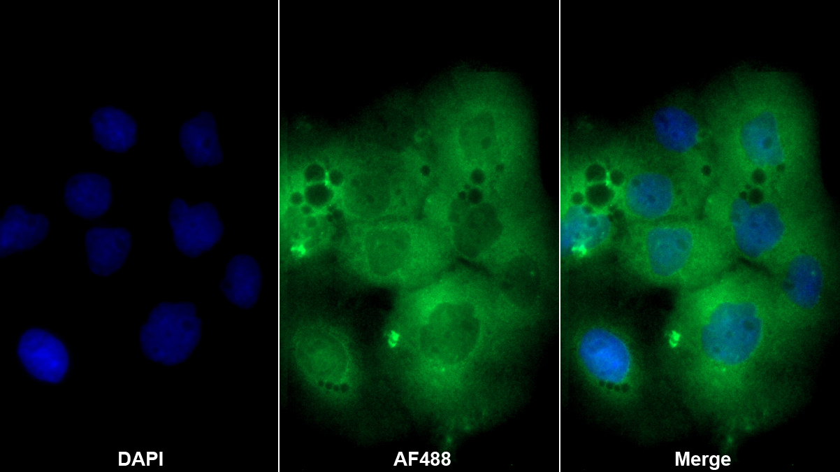 含BRCA1/BRCA2復(fù)合體3亞基(BRCC3)多克隆抗體