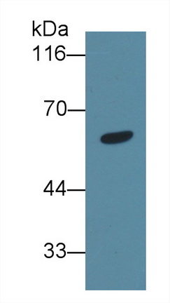 血管生成素样蛋白6(ANGPTL6)多克隆抗体