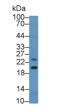 非转移细胞6表达蛋白(NME6)多克隆抗体