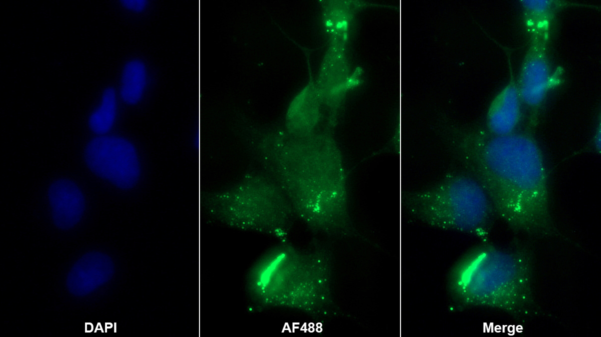 Gremlin 2蛋白(GREM2)多克隆抗體