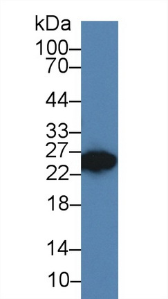 Dickkopf样蛋白1(DKKL1)多克隆抗体