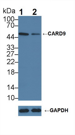 胱天蛋白酶富集域家族成员9(CARD9)多克隆抗体