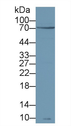 70kDaζ鏈關聯(lián)蛋白激酶(zAP70)多克隆抗體