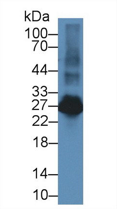 T-细胞激活连接蛋白家族成员2(LAT2)多克隆抗体