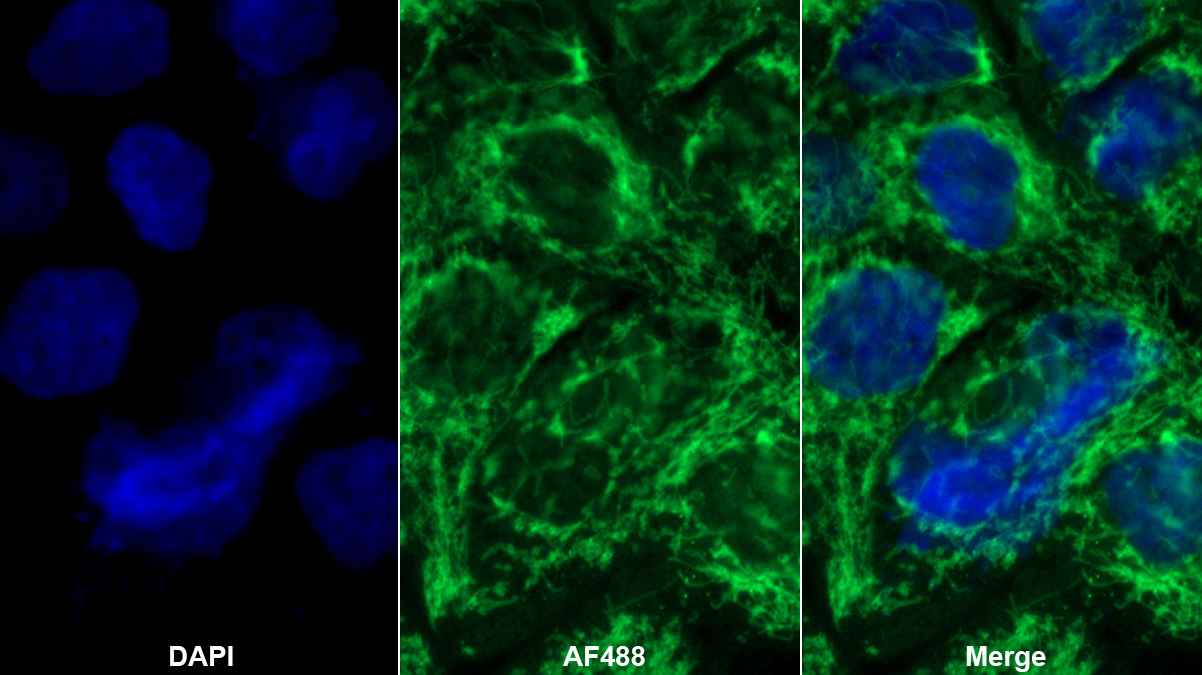 線粒體外膜轉(zhuǎn)位酶70A(TOMM70A)多克隆抗體