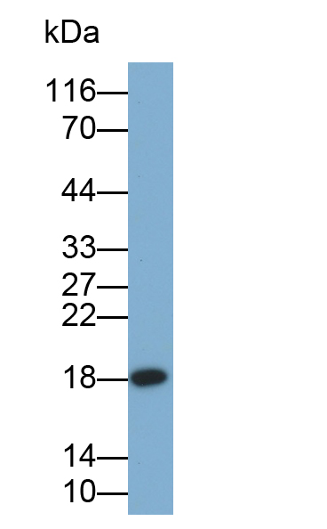 核糖体蛋白L23A(RPL23A)多克隆抗体