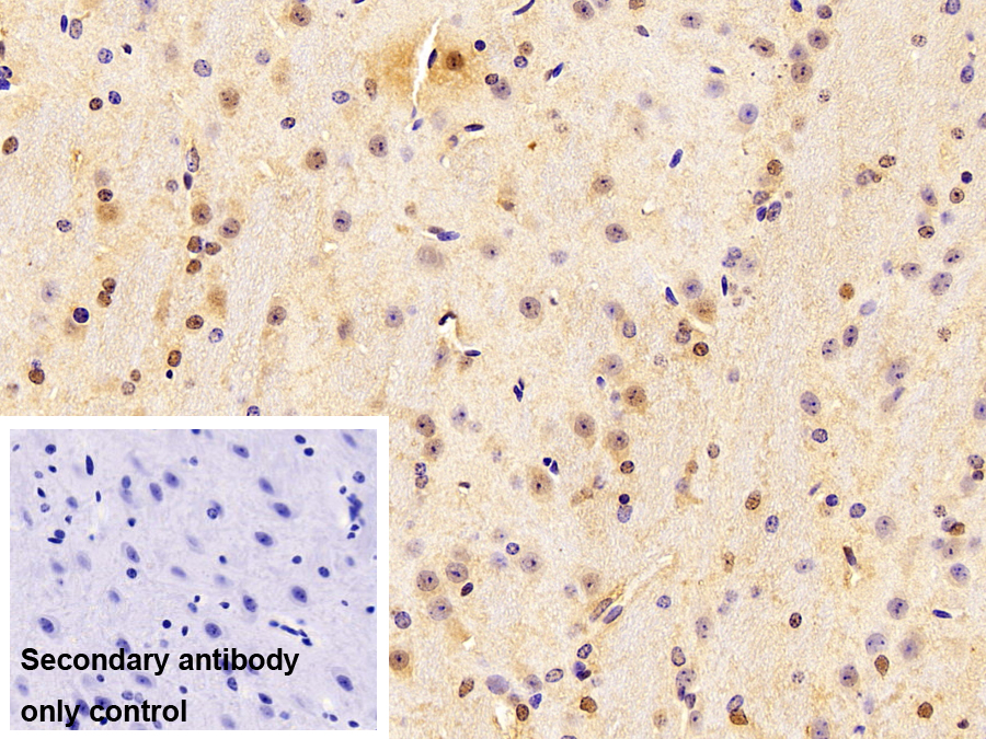 RAD23同源物B(RAD23B)多克隆抗体