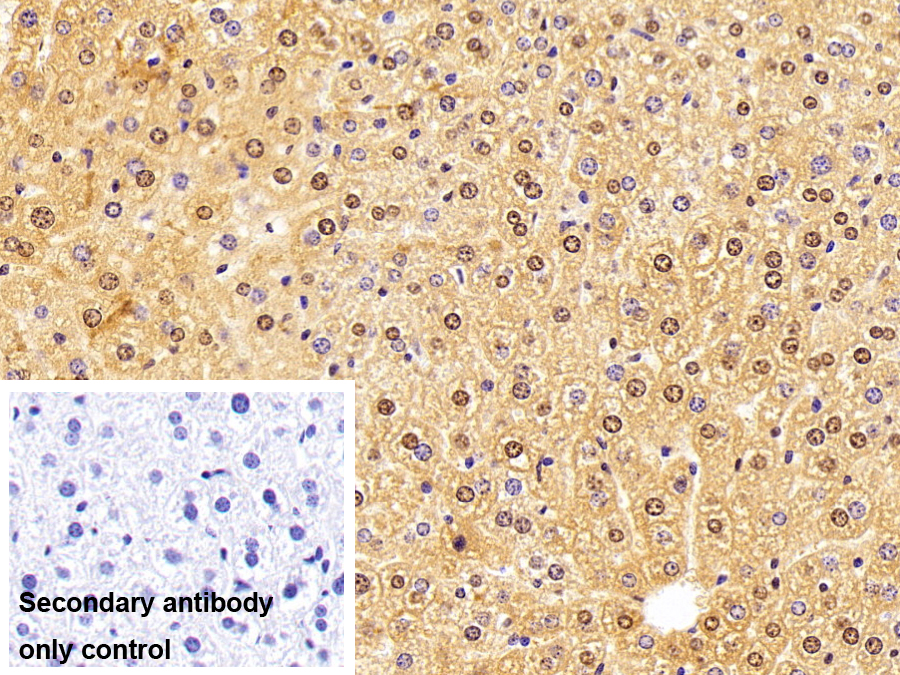 RAD23同源物B(RAD23B)多克隆抗体