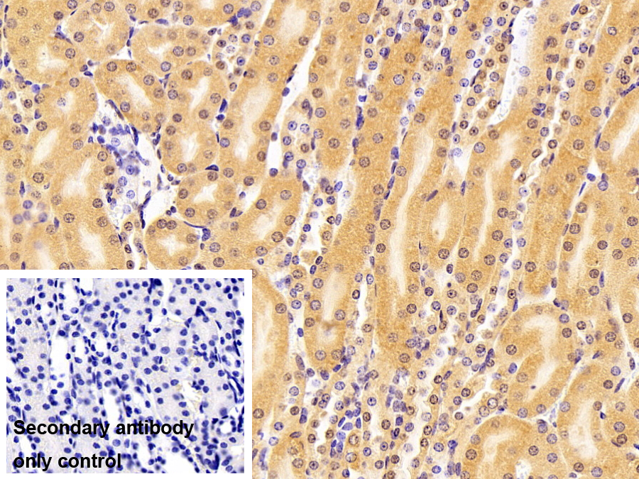 RAD23同源物B(RAD23B)多克隆抗体