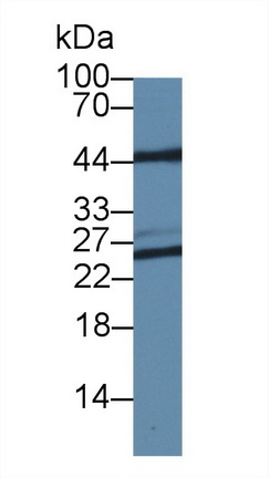非ATP酶蛋白酶体26S亚基8(PSMD8)多克隆抗体