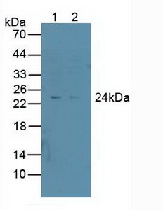 非ATP酶蛋白酶体26S亚基10(PSMD10)多克隆抗体