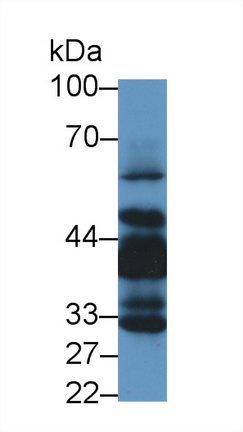 LIM衰老细胞抗原样域蛋白1(LIMS1)多克隆抗体