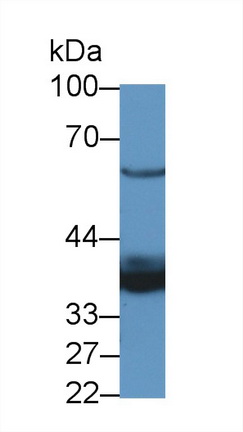 LIM衰老细胞抗原样域蛋白1(LIMS1)多克隆抗体