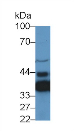 LIM衰老细胞抗原样域蛋白1(LIMS1)多克隆抗体