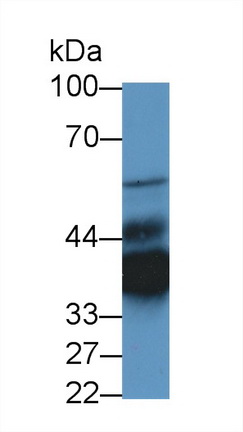 LIM衰老细胞抗原样域蛋白1(LIMS1)多克隆抗体