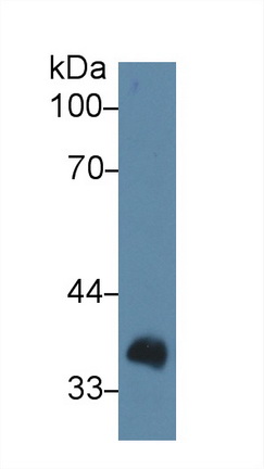 LIM衰老细胞抗原样域蛋白1(LIMS1)多克隆抗体