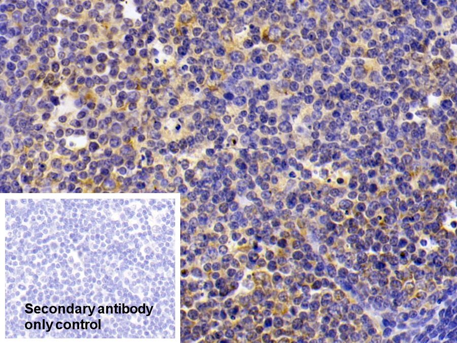 LIM衰老细胞抗原样域蛋白1(LIMS1)多克隆抗体
