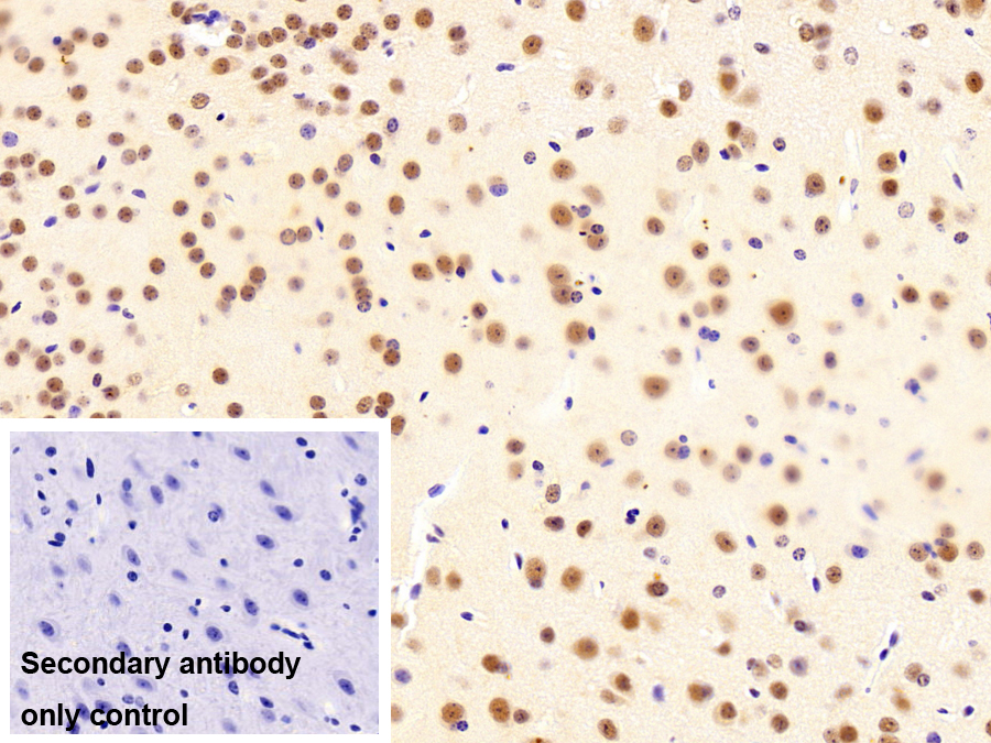 HIV1 Tat特異性因子1(HTATSF1)多克隆抗體