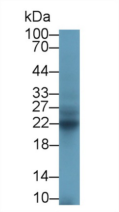 CD8b分子(CD8b)多克隆抗体