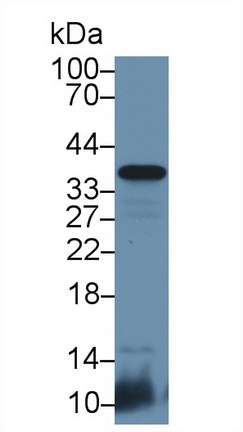 CD8b分子(CD8b)多克隆抗體