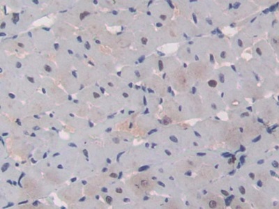 CD8b分子(CD8b)多克隆抗體
