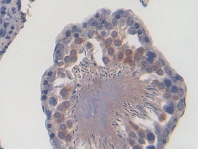 CD8b分子(CD8b)多克隆抗體