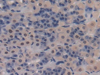 CD8b分子(CD8b)多克隆抗體