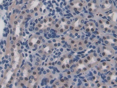 CD8b分子(CD8b)多克隆抗體