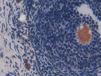 CD8b分子(CD8b)多克隆抗體